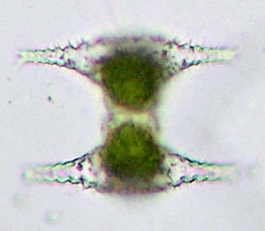 Staurastrum manfeldtii